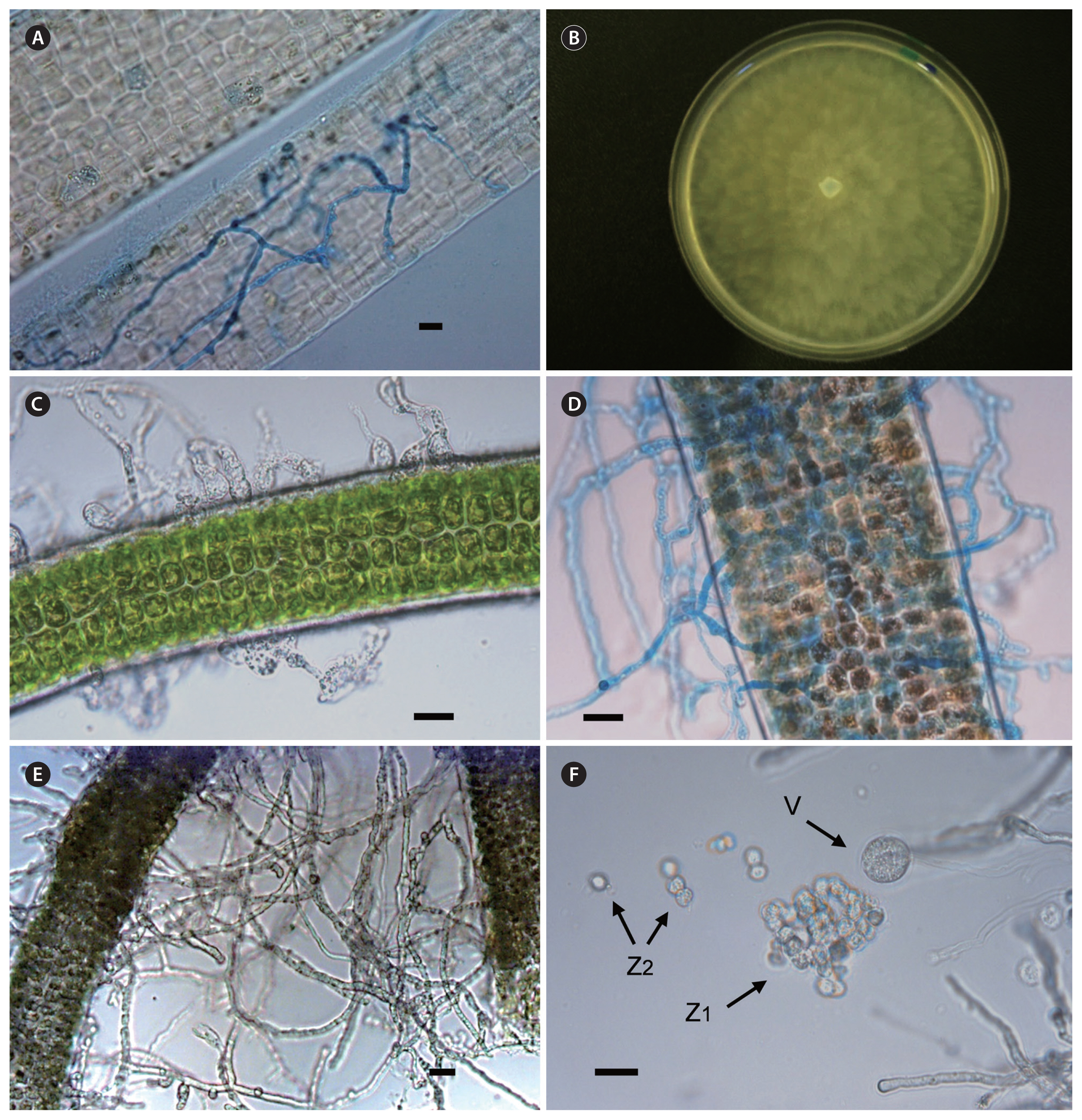 algae-2020-35-1-79f1.jpg